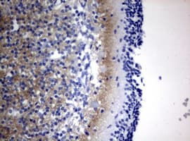 VILIP / VSNL1 Antibody (aa2-191, clone OTI1C8, Carrier-free)