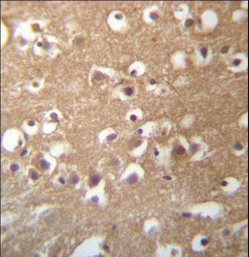 Polyclonal Rabbit anti-Human TMCC3 Antibody (aa133-162, IHC, WB)