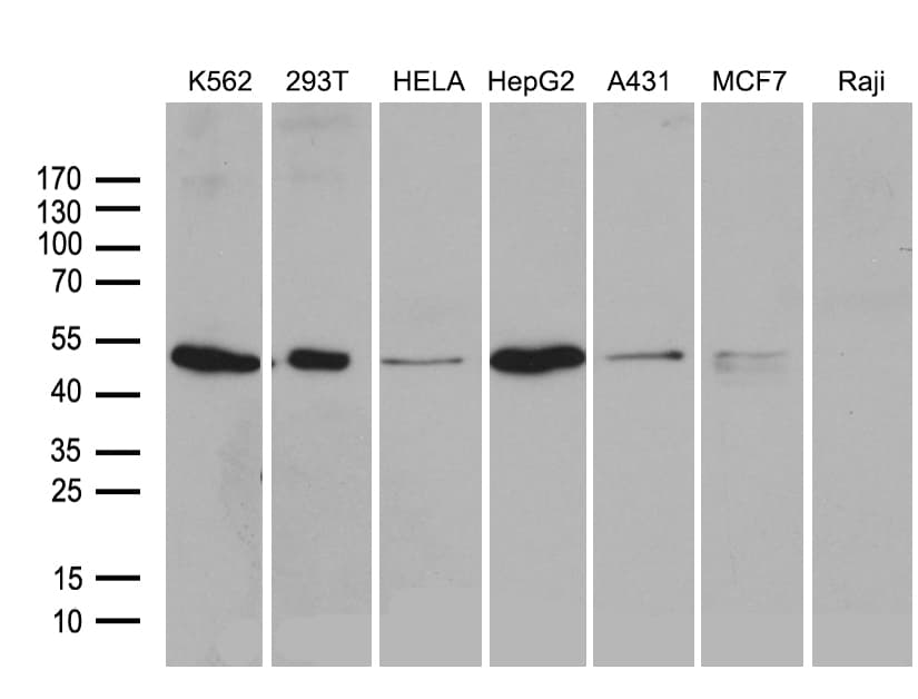 Monoclonal Mouse anti-Human ZFYVE1 / DFCP1 Antibody (clone OTI4H7, aa1-308, WB)