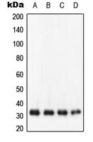 Polyclonal Rabbit anti-Human NQO1 Antibody (C-Terminus, WB)