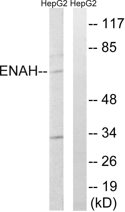 ENAH / MENA Antibody (aa472-521)