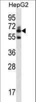 GGT2 Antibody (aa12-40)