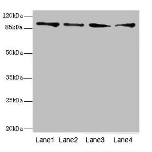 TNNI3K / CARK Antibody