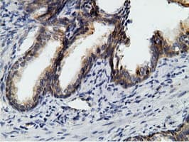 KHK / Ketohexokinase Antibody (clone OTI3D1)