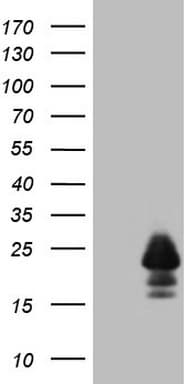 MLANA / Melan-A Antibody (aa48-118, clone OTI2E7)