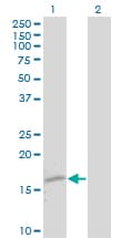 Monoclonal Mouse anti-Human TTR / Transthyretin Antibody (clone 4D8, WB)