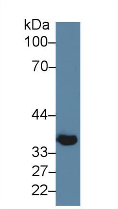 KLB / Beta Klotho Antibody (aa846-965, PE)