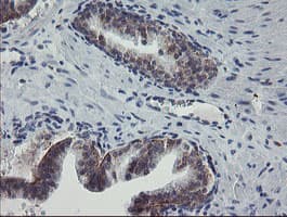 APP / Beta Amyloid Precursor Antibody (clone OTI6F11, Carrier-free)