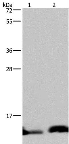 NDUFA5 Antibody