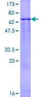 Human BCS1L Protein (Recombinant GST)