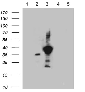 SSTR3 Antibody (clone OTI9A7)