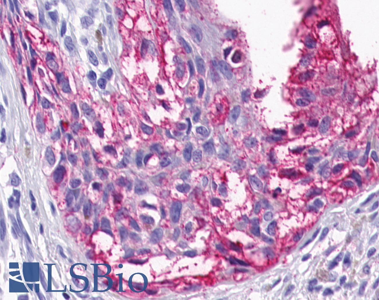 PathPlus™ Polyclonal Rabbit anti-Human HTR4 / 5-HT4 Receptor Antibody (Cytoplasmic Domain, IHC)