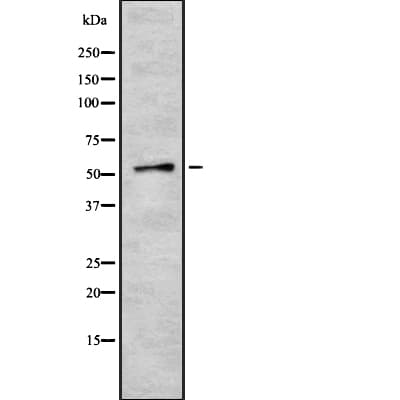 Polyclonal Rabbit anti-Human ZNF768 Antibody (IHC, WB)