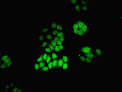 Polyclonal Rabbit anti-Human MAT2A Antibody (IHC)