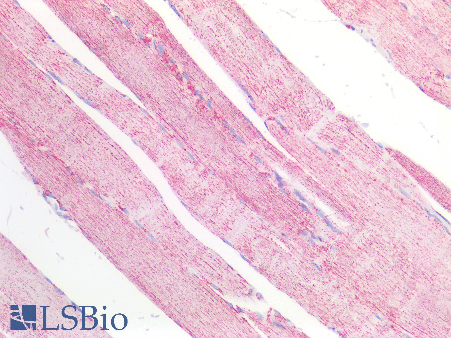 IHC-plus™ Polyclonal Goat anti-Human MDH / MDH2 Antibody (Internal Region, IHC, WB)