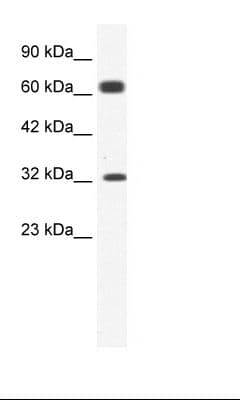 KCNN1 Antibody (aa441-490)