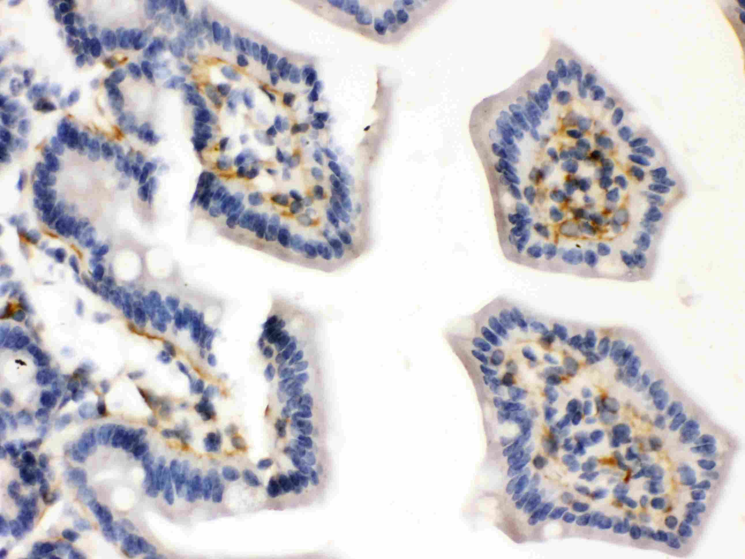 CALD1 / Caldesmon Antibody