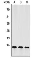 IHC-plus™ FSHB / FSH Beta Antibody (Internal)