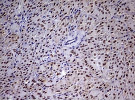CDCA7L Antibody (aa1-337, clone OTI3B5, Carrier-free)