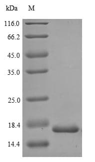 Human MKI67 / Ki67 Protein (Recombinant 6His, N-terminus)