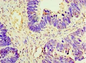 AMH / Anti-Mullerian Hormone Antibody (aa26-560)