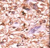 TP53 / p53 Antibody (phospho-Thr18)