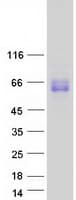 Human UGT1A3 Protein (Recombinant Myc-DDK (Flag))
