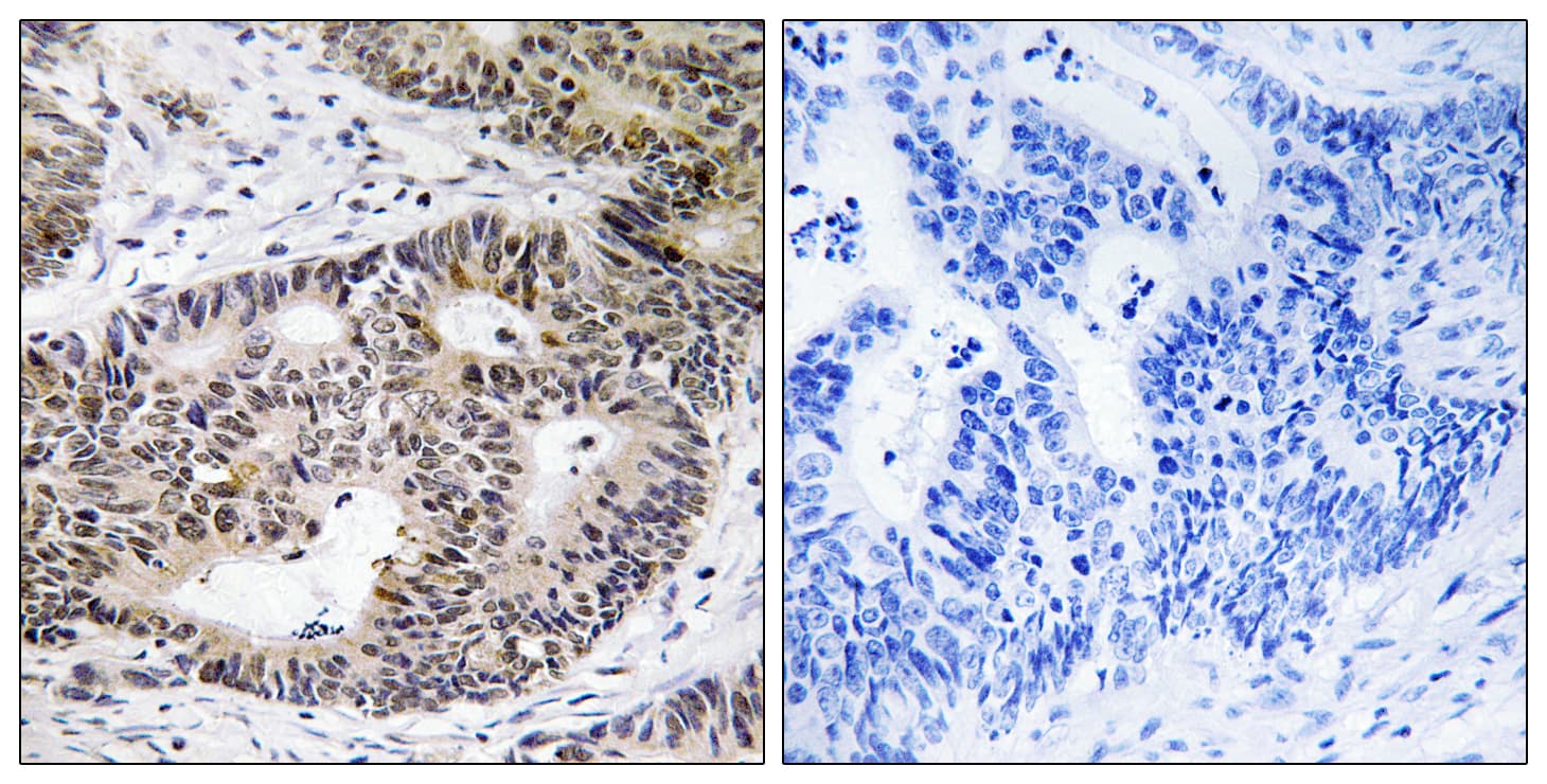 Polyclonal Rabbit anti-Human ZFYVE19 Antibody (aa311-360, IHC, WB)