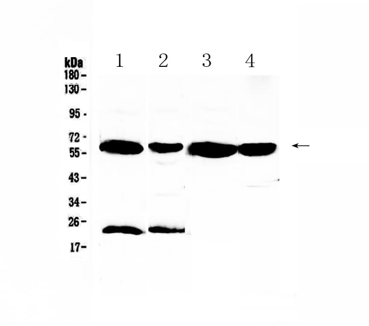 UGT1A / UGT1A1 Antibody
