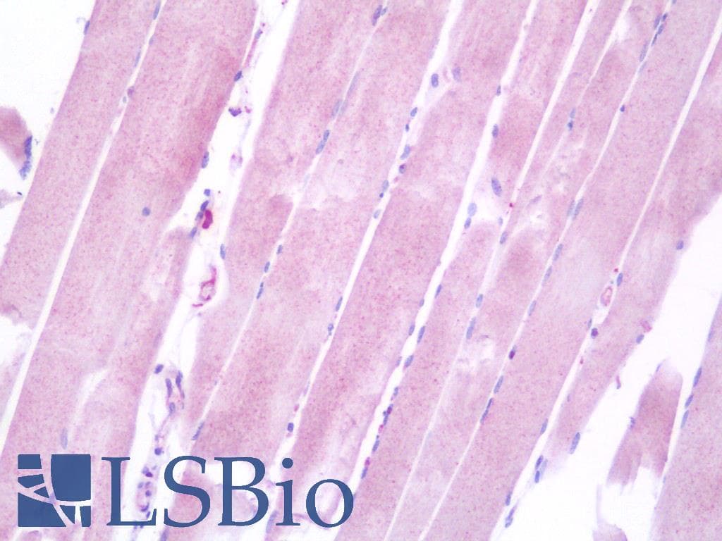 IHC-plus™ ACTN3 Antibody (aa409-437)