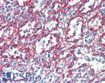IHC-plus™ CLTC / Clathrin Heavy Chain Antibody