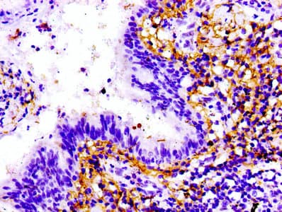 TTN / Titin Antibody (aa5398-5604)