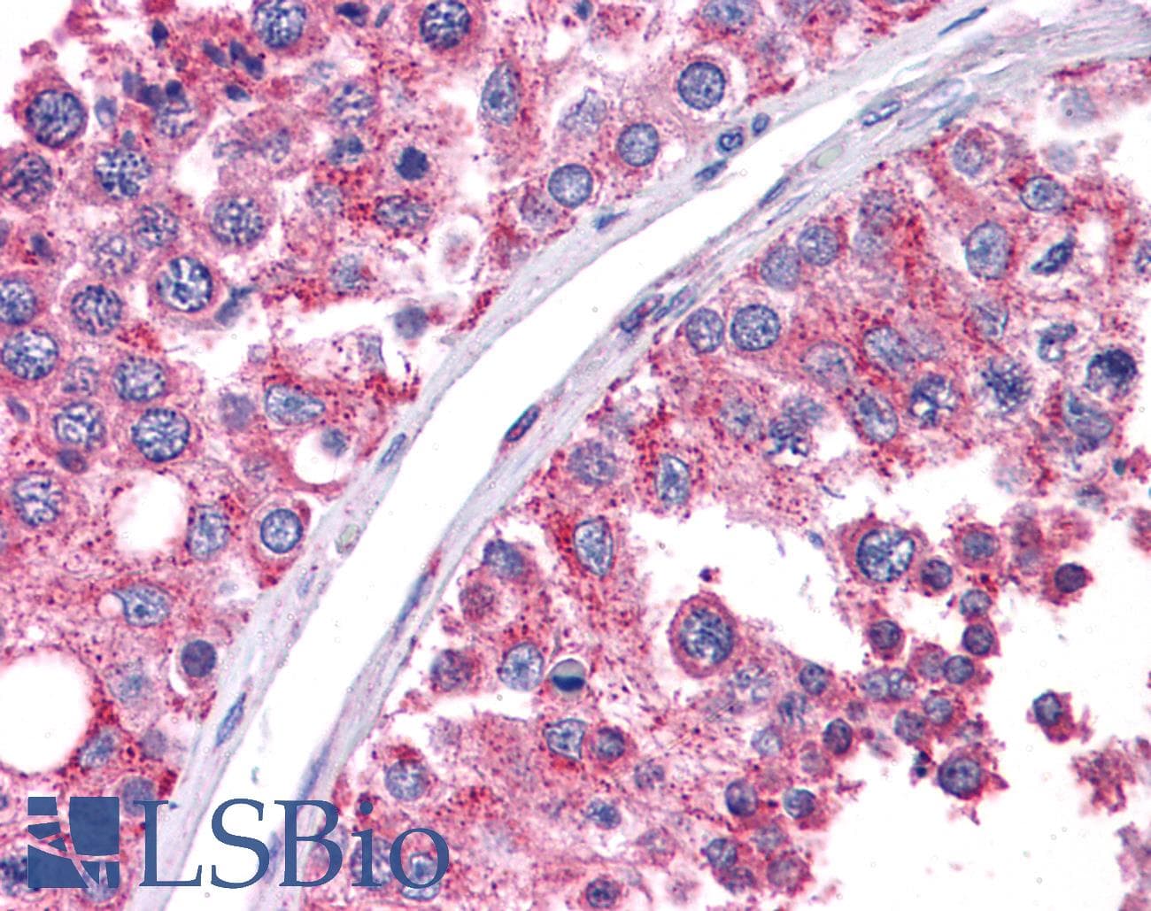 IHC-plus™ WT1 / Wilms Tumor 1 Antibody (aa396-448)