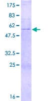 Human COQ4 Protein (Recombinant GST)