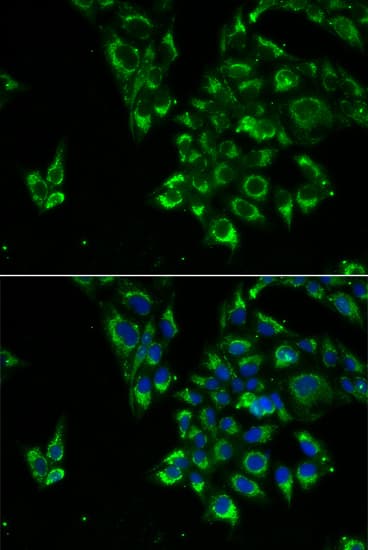 TSHB / TSH-Beta Antibody