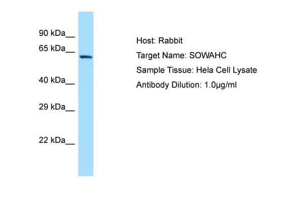 SOWAHC / ANKRD57 Antibody (aa128-177)