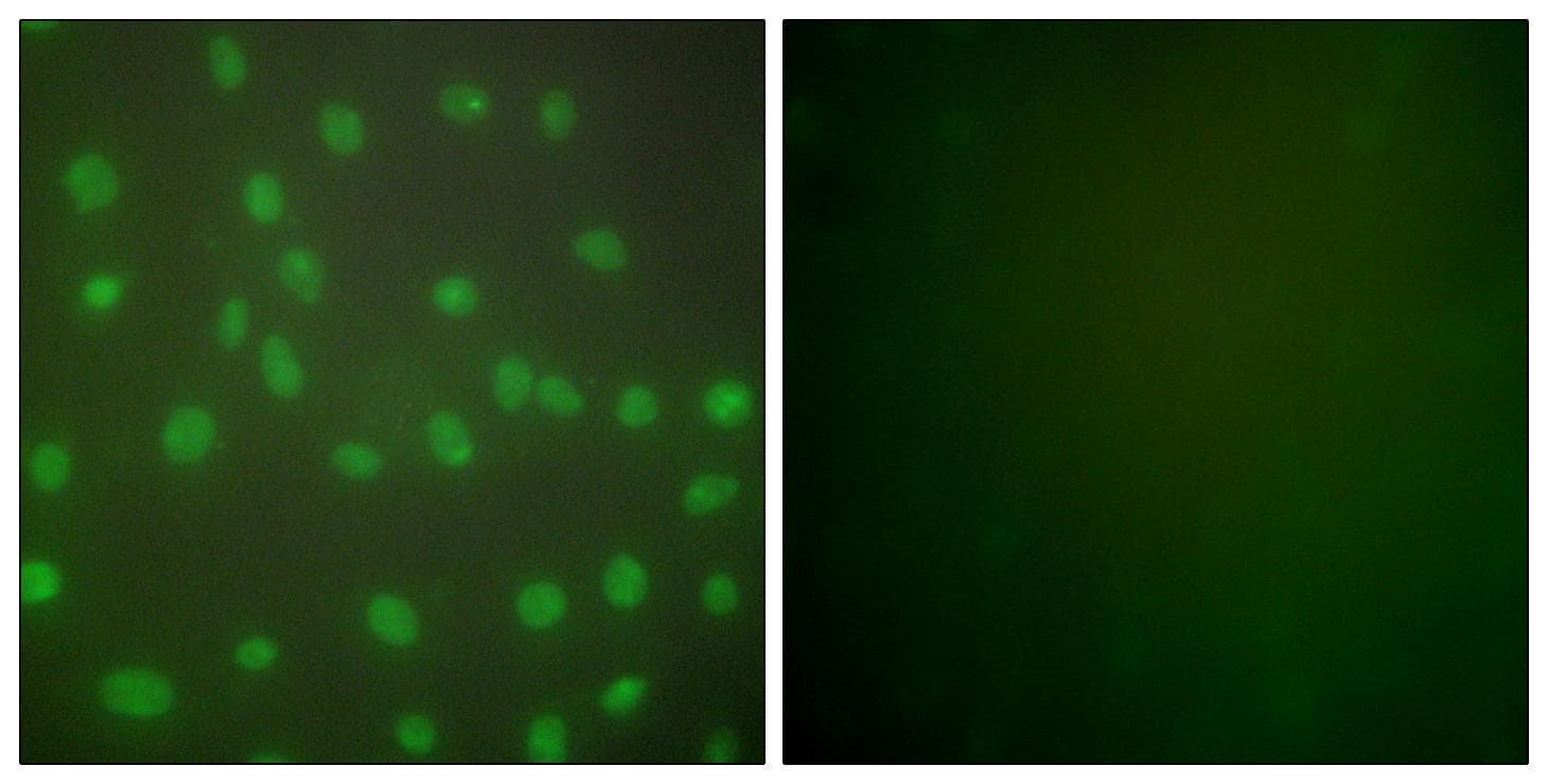 Polyclonal Rabbit anti-Human HDAC1 Antibody (IHC, IF, WB)