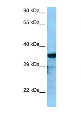 RGS4 Antibody (C-Terminus)
