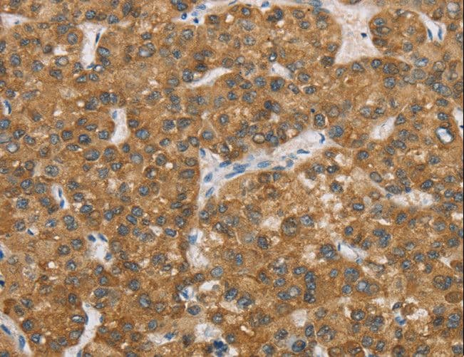 Polyclonal Rabbit anti-Human ENTPD5 / CD39L4 Antibody (IHC, WB)