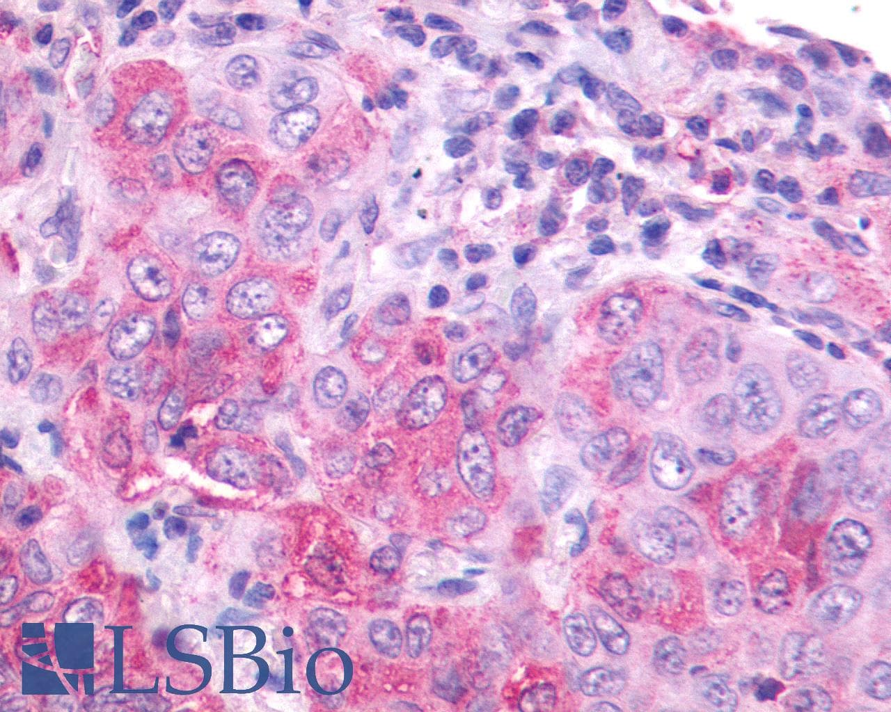 PathPlus™ NMBR Antibody (Cytoplasmic Domain)