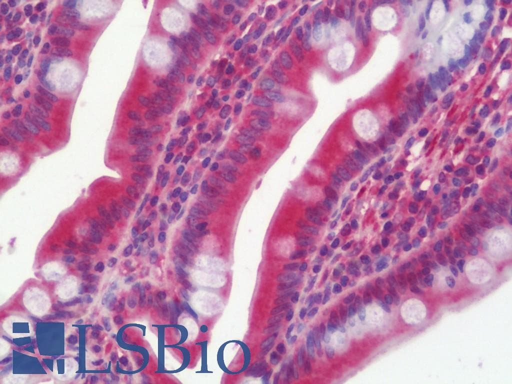 IHC-plus™ Polyclonal Rabbit anti-Human PFKM / PFK-1 Antibody (aa1-253, IHC, WB)