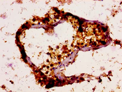 UBE2N / UBC13 Antibody