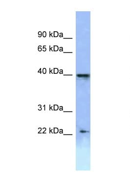 Polyclonal Rabbit anti-Human HOXA2 Antibody (aa220-269, WB)