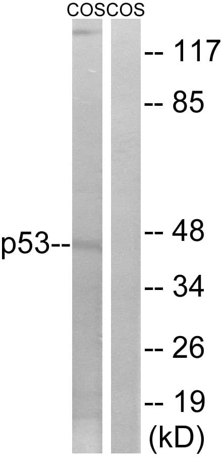 Polyclonal Rabbit anti-Human TP53 / p53 Antibody (aa8-57, WB)