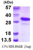 Human PSMA8 Protein (Recombinant His)