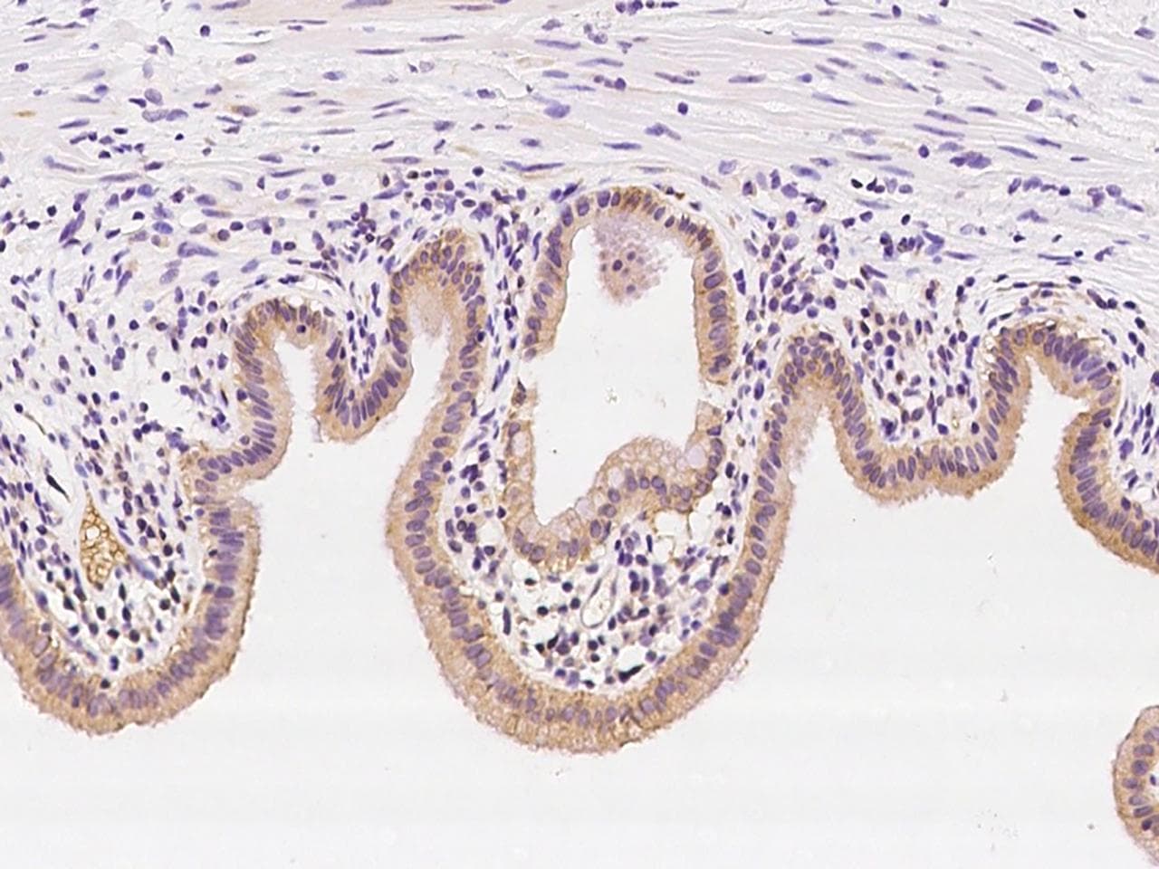 SS18L2 Antibody