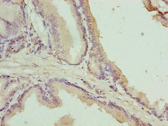 C17orf64 Antibody