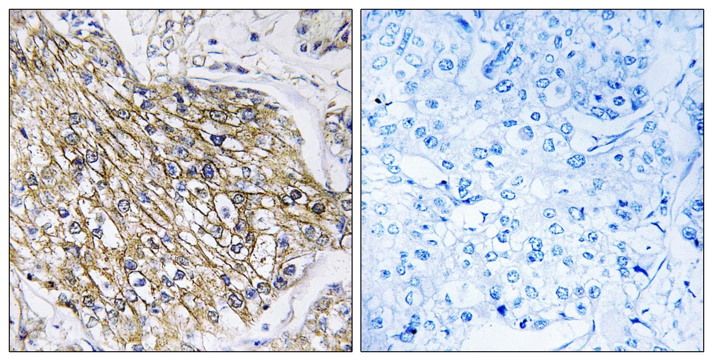 ADGRL2 / LPHN2 Antibody