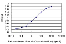IHC-plus™ IRAK1 / IRAK Antibody (clone 3F7)