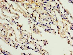 ADAM33 Antibody (aa140-420)